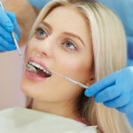 Dental Splint for Loose Teeth: How It Works and When You Might Need One