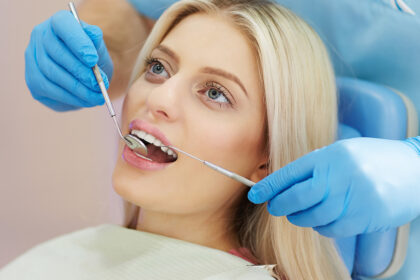 Dental Splint for Loose Teeth: How It Works and When You Might Need One